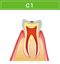 C1