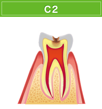 C2