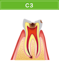 C3